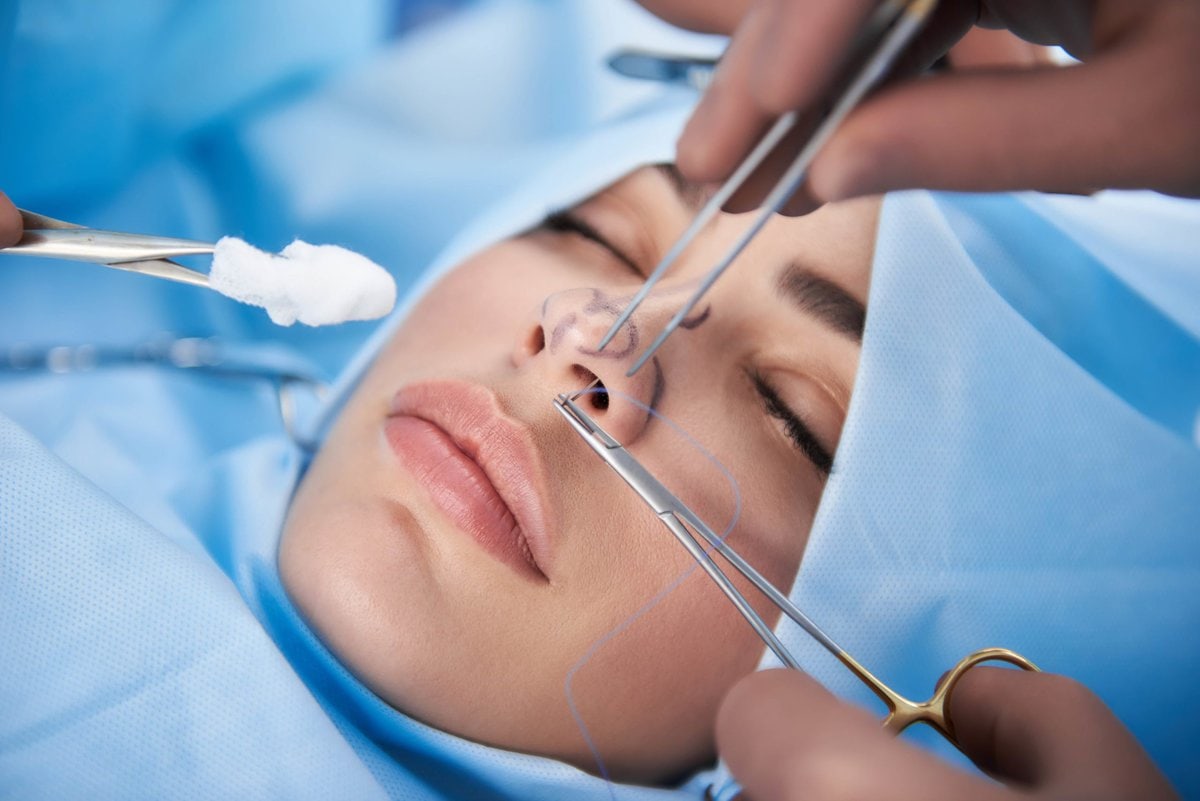 Rhinoplasty procedure