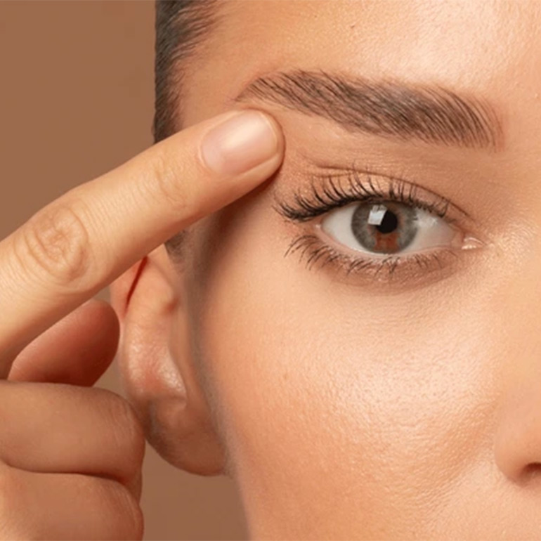 Blepharoplasty