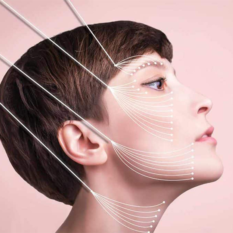 Facelift