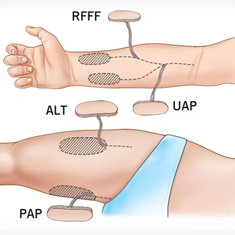 Free Flap Reconstruction