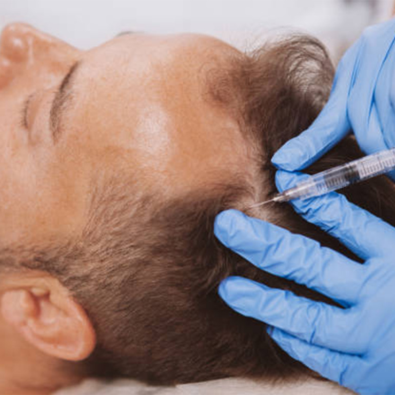 PRP Therapy