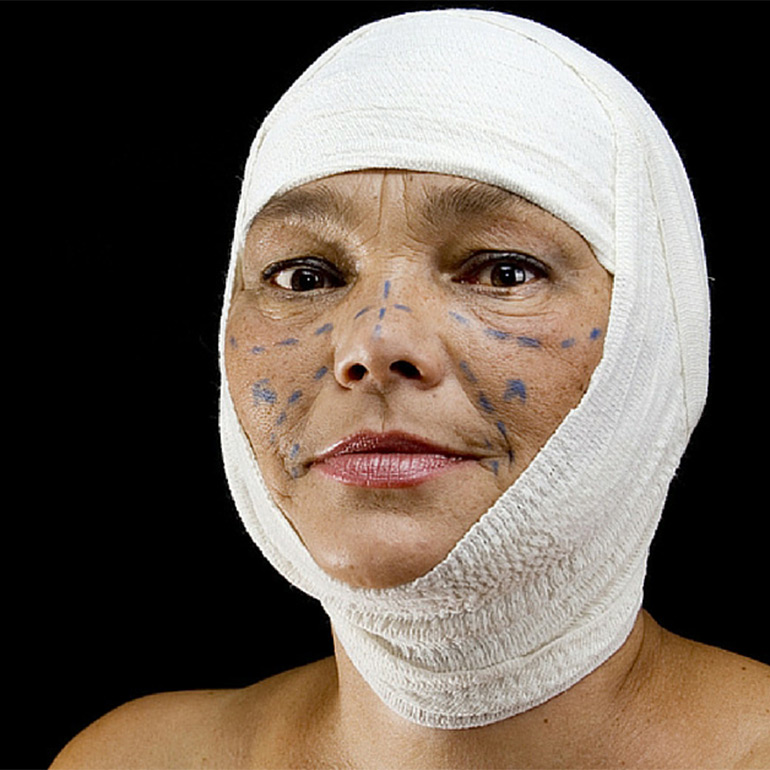 Burn Reconstruction