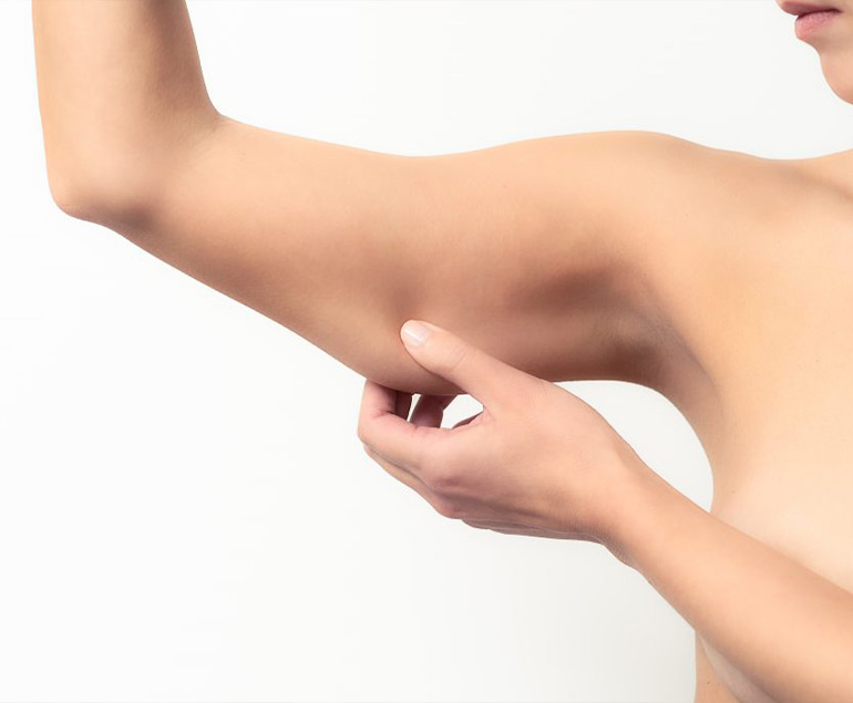 Brachioplasty procedure