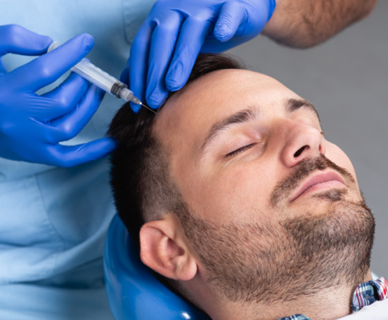 PRP Treatment